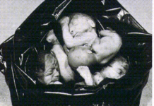 L’aborto: omicidio che segna per sempre la donna