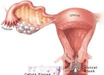 PREVENZIONE DEL TUMORE DEL COLLO DELL’UTERO: STUDIO ITALIANO DIMOSTRA IL VALORE DEL TEST HPV HC2
